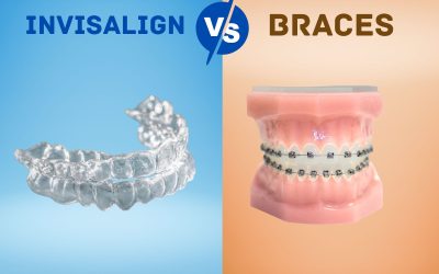Invisalign vs Braces: Which Is the Right Choice for You?