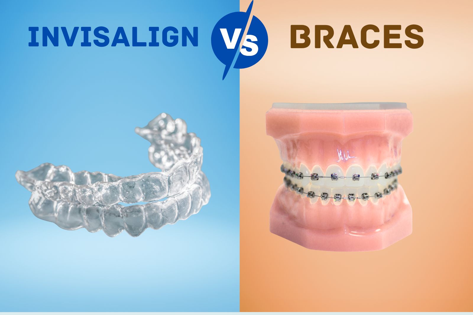 Invisalign vs Braces